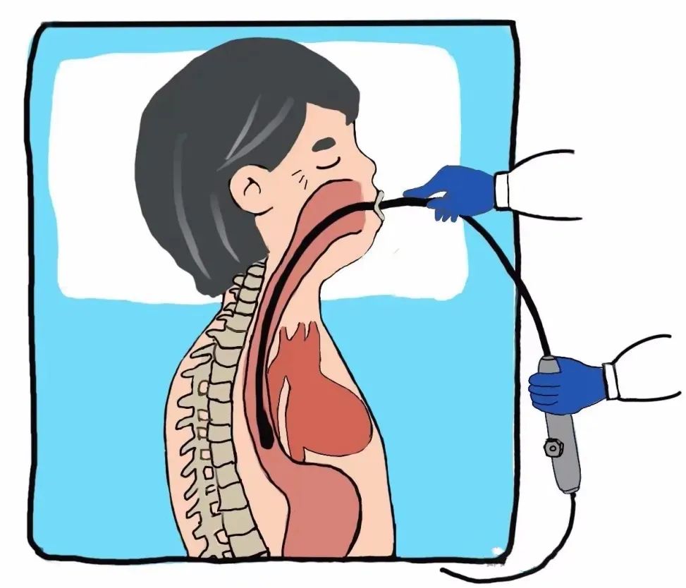 小探頭看大病 | 經(jīng)食道超聲立大功！